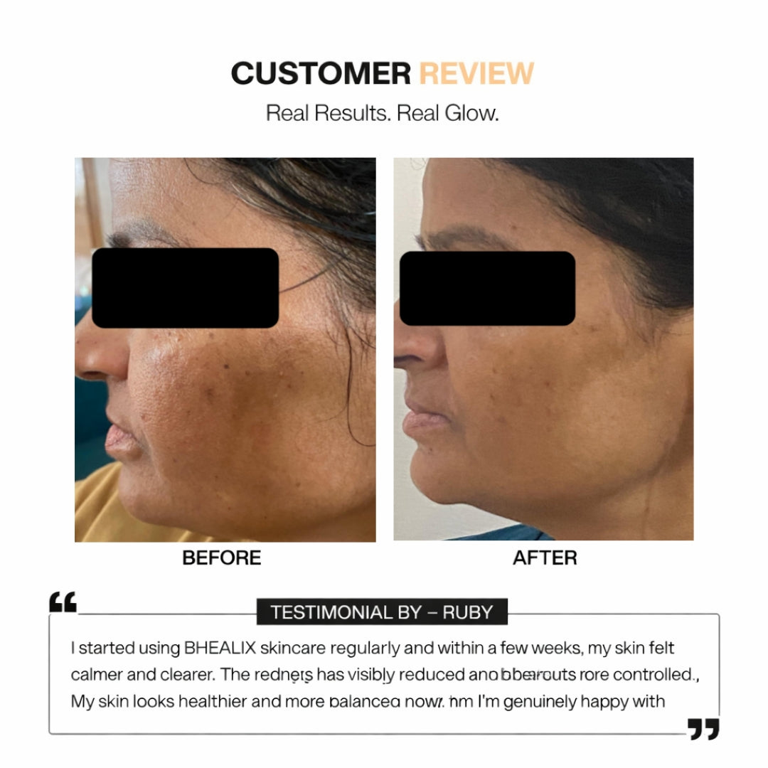 Vitamin-C Face Serum