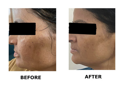Vitamin C Face Serum