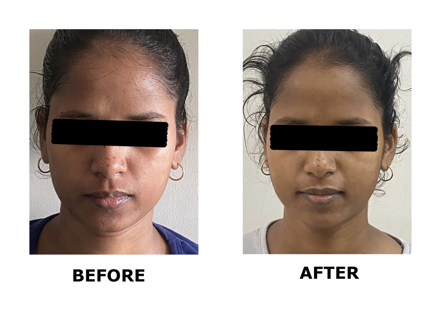 Vitamin C Face Serum
